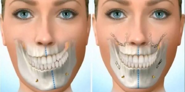 Cirugia-maxilofacial
