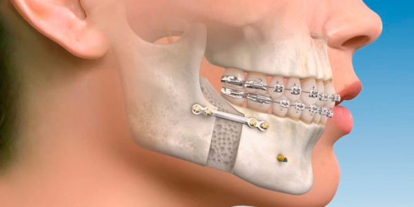 cirugia-maxilofacial-cabecera-1