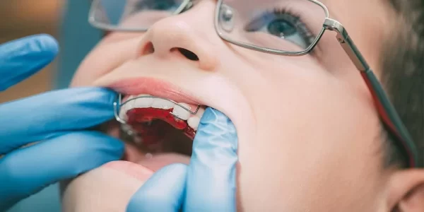 ortodoncia-infantil-