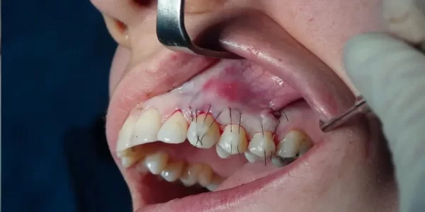 otros-trata_periodoncia-1024x576